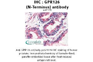 Image no. 2 for anti-G Protein-Coupled Receptor 126 (GPR126) (N-Term) antibody (ABIN1734925)