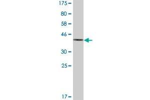 Western Blot detection against Immunogen (36. (AKR1C2 anticorps  (AA 224-323))