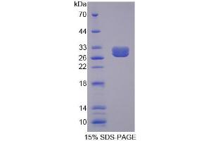 SDS-PAGE analysis of Mouse BCR Protein. (BCR Protéine)