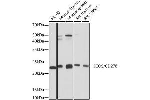 Western blot analysis of extracts of various cell lines, using ICOS/CD278 Rabbit mAb (ABIN7267869) at 1:1000 dilution. (ICOS anticorps)