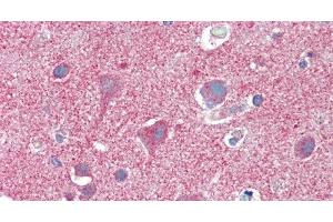 Immunohistochemistry of paraffin-embedded Brain, Cortex tissue using CLTC Polyclonal Antibody at dilution of 1:60.