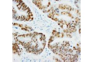 Image no. 1 for anti-Tumor Protein P53 (TP53) antibody (Magnetic Particles) (ABIN1502096) (p53 anticorps  (Magnetic Particles))