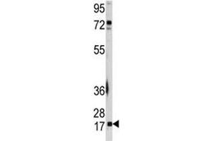 Western blot analysis of UBE2I antibody and A2058 lysate.