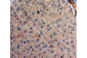 Used in DAB staining on fromalin fixed paraffin-embedded Liver tissue (Neuregulin 4 anticorps  (AA 1-62))