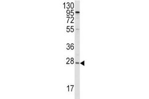 Western blot analysis of APOA1 antibody and HepG2 lysate. (APOA1 anticorps  (AA 10-37))