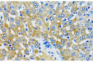 Immunohistochemistry of paraffin-embedded Rat liver using HDAC5 Polyclonal Antibody at dilution of 1:100 (40x lens).