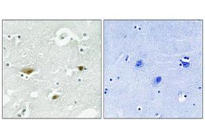 Immunohistochemical analysis of paraffin-embedded human brain tissue using STK39 (Phospho-Ser323) antibody (left)or the same antibody preincubated with blocking peptide (right). (STK39 anticorps  (pSer325))