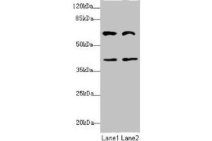 Western blot All lanes: DCP1A antibody at 3. (DCP1A anticorps  (AA 303-582))
