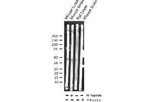 Western blot analysis of Phospho-Aurora Kinase (Thr288) expression in various lysates (Aurora A anticorps  (pThr288))