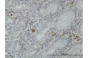 Image no. 3 for anti-Fibrinogen-Like 2 (FGL2) (AA 24-124) antibody (ABIN466173) (FGL2 anticorps  (AA 24-124))