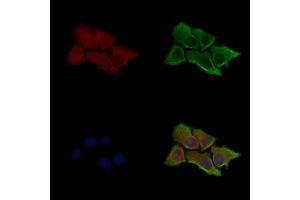 Phospho-CaMKII alpha (Ser331) Antibody staining HepG2 cells(serum starvation treatment) by IF/ICC. (CAMK2A anticorps  (pSer331))