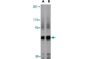 Western blot analysis of NCSTN in mouse brain tissue lysate with NCSTN polyclonal antibody  at (A) 0. (Nicastrin anticorps  (Internal Region))