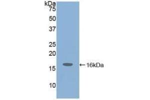 Detection of Recombinant IGF1, Mouse using Polyclonal Antibody to Insulin Like Growth Factor 1 (IGF1)