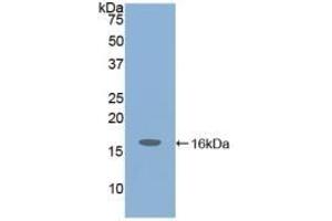 Detection of Recombinant IGF1, Mouse using Polyclonal Antibody to Insulin Like Growth Factor 1 (IGF1) (IGF1 anticorps  (AA 49-153))