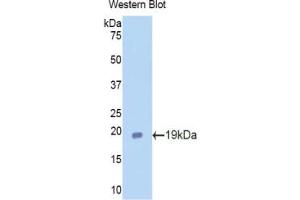 Western blot analysis of the recombinant protein. (Lactoferrin anticorps  (AA 64-193))