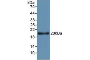 Detection of Recombinant APOL2, Human using Monoclonal Antibody to Apolipoprotein L2 (APOL2) (Apolipoprotein L 2 anticorps  (AA 186-337))