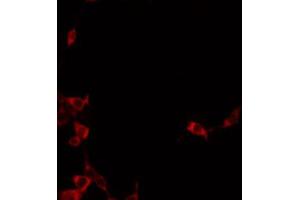 ABIN6272341 staining A549 by IF/ICC. (ST14 anticorps  (Internal Region))