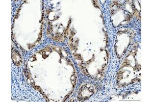 IHC analysis of Aurora A/AURKA using anti-Aurora A/AURKA antibody (ABIN7600751). (Aurora A anticorps  (AA 23-403))