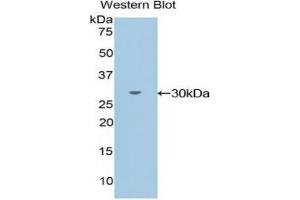 Western blot analysis of the recombinant protein. (TXK anticorps  (AA 286-509))