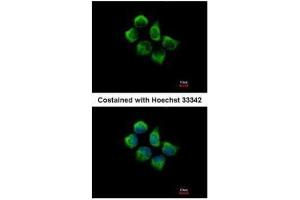 ICC/IF Image Immunofluorescence analysis of methanol-fixed A431, using SNX12, antibody at 1:500 dilution. (SNX12 anticorps  (C-Term))