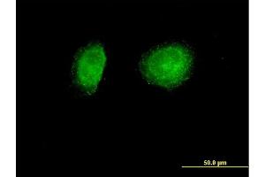 Immunofluorescence of purified MaxPab antibody to SNX1 on HeLa cell.