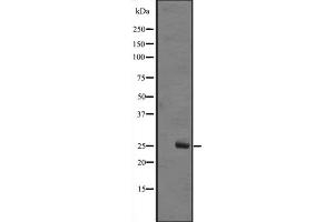 anti-MOB1, Mps One Binder Kinase Activator-Like 1B (MOBKL1B) (Internal Region) antibody