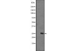 Western blot analysis of MOBKL1B expression in A431 whole cell lysate ,The lane on the left is treated with the antigen-specific peptide. (MOB1A anticorps  (Internal Region))