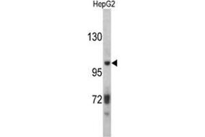Western blot analysis of ITIH2 antibody (C-term) in HepG2 cell line lysates (35ug/lane). (ITIH2 anticorps  (C-Term))