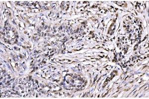 IHC analysis of CBX1/HP1 beta using anti-CBX1/HP1 beta antibody (ABIN7602012).