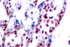 Image no. 2 for anti-Activating Transcription Factor 2 (ATF2) antibody (ABIN265320)