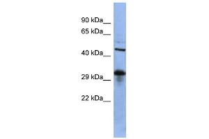 WB Suggested Anti-SOX2 Antibody Titration:  0. (SOX2 anticorps  (Middle Region))