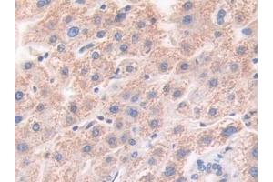 Detection of HLTF in Human Liver Tissue using Polyclonal Antibody to Helicase Like Transcription Factor (HLTF)