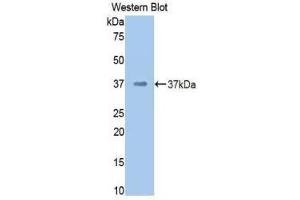 Western Blotting (WB) image for anti-Coagulation Factor II (thrombin) (F2) (AA 325-618) antibody (ABIN3207761) (Prothrombin anticorps  (AA 325-618))