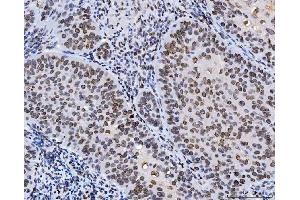 IHC analysis of Lamin A+C/LMNA using anti-Lamin A+C/LMNA antibody (ABIN7601843). (Lamin A/C anticorps  (AA 481-646))