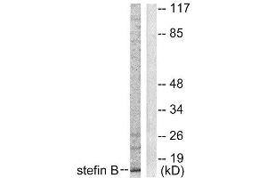 Western Blotting (WB) image for anti-Cystatin B (Stefin B) (CSTB) (Internal Region) antibody (ABIN1848780)