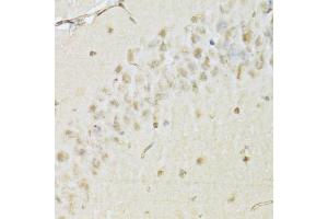 Immunohistochemistry of paraffin-embedded mouse brain using HDAC3 Antibody (ABIN5971166) at dilution of 1/100 (40x lens). (HDAC3 anticorps)