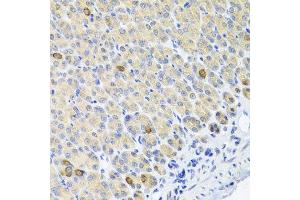 Immunohistochemistry of paraffin-embedded mouse stomach using GLS antibody at dilution of 1:100 (x40 lens). (Glutaminase anticorps)