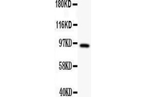 Anti- DISC1 antibody,  Western blotting All lanes: Anti DISC1 () at 0. (DISC1 anticorps  (N-Term))