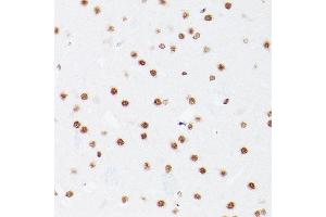 Immunohistochemistry of paraffin-embedded Rat brain using NSUN5 antibody ( ABIN7268955) at dilution of 1:100 (40x lens).