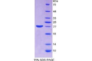 SDS-PAGE analysis of Human ECT2 Protein. (ECT2 Protéine)