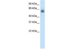 WB Suggested Anti-GRHL3 Antibody Titration: 0. (GRHL3 anticorps  (C-Term))