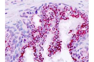 Human, Prostate: Formalin-Fixed Paraffin-Embedded (FFPE)