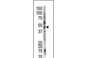 Antibody is used in Western blot to detect PSMD4 in Jurkat cell lysate. (PSMD4/ASF anticorps  (C-Term))
