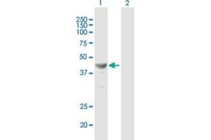 Western Blot analysis of TFAP2E expression in transfected 293T cell line ( H00339488-T01 ) by TFAP2E MaxPab polyclonal antibody.