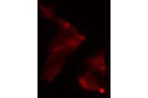 ABIN6275084 staining  LOVO cells by IF/ICC. (RNF111 anticorps  (C-Term))