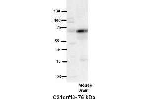 WB Suggested Anti-C21orf13 Antibody Titration:  5% Milk  ELISA Titer:  dilution: 1:500  Positive Control:  Mouse Brain lysate (LCA5L anticorps  (N-Term))
