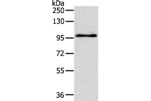 Western blot analysis of Hela cell using EPHA3 Polyclonal Antibody at dilution of 1:400 (EPH Receptor A3 anticorps)