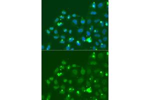 Immunofluorescence analysis of A549 cell using ATF3 antibody. (ATF3 anticorps  (AA 1-181))