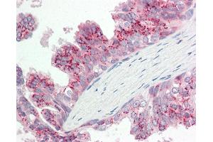 Human Prostate: Formalin-Fixed, Paraffin-Embedded (FFPE). (ATG4B anticorps  (AA 110-159))