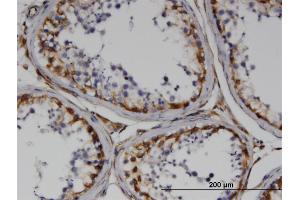 Immunoperoxidase of monoclonal antibody to RND3 on formalin-fixed paraffin-embedded human testis.